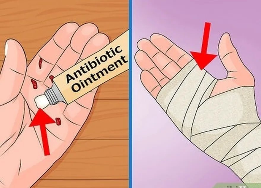 addım 10, yaralara antibiotik məlhəm tətbiq edin.